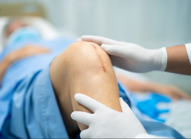 Best Knee Replacement Specialist in Sion, Mumbai